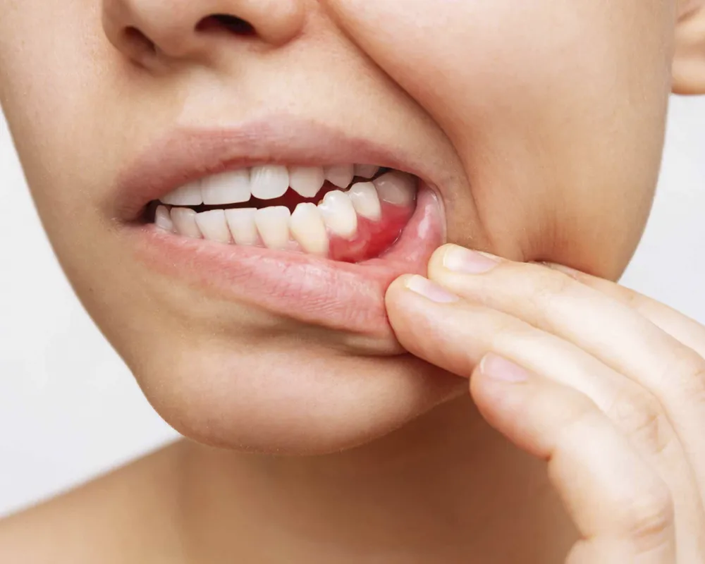 Salud de las encías y cuidado periodontal